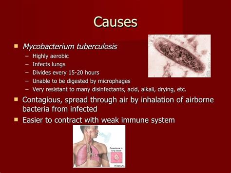 sulasok.tb|tb caused by bacteria.